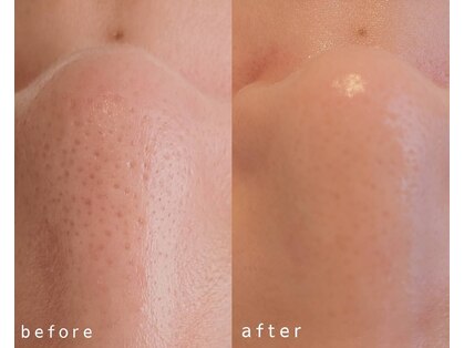 ブリリア モア(Brillia Moi)の写真