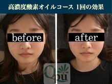 キュープ 表参道店(Qpu)/続けた方しか感じられない変化♪