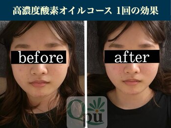 キュープ 表参道店(Qpu)/続けた方しか感じられない変化♪