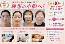 アガルコガオサロン(AGARU KOGAO SALON)