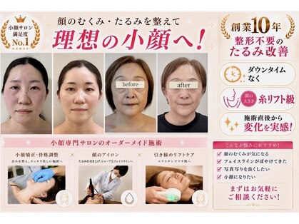 アガルコガオサロン(AGARU KOGAO SALON)の写真