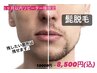 【男性のみ】1ヶ月以内来店★都度払い/痛みほぼないヒゲ脱毛10000円→8500円