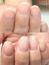 マリーロール 梅田店(Marie Laure)/自爪育成/深爪矯正/ネイルケア
