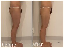 美人バスト 新宿店/☆姉妹店ダイエット症例写真☆