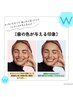 圧倒的白い歯に☆ホワイトニング20分×2回　¥6,600