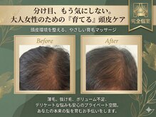 グリーンノート(GREEN NOTE)/【育毛】を促す頭皮ケア！