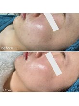 アンドワイ バイ サロンリーナ(&y by Salon Lena)