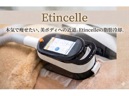 エタンセル(Etincelle)の写真