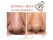 トイ(Toi)の雰囲気(横須賀初導入【esV10】肌管理)