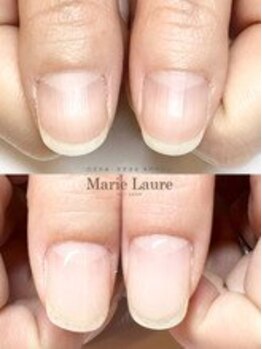 マリーロール 梅田店(Marie Laure)/自爪育成/深爪矯正/ネイルケア
