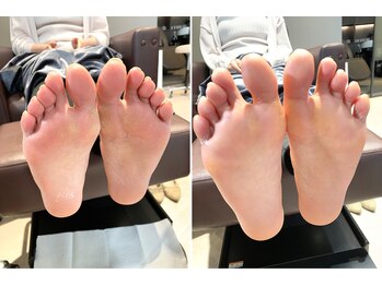 ウノプリール 梅田HARBIS PLAZA(uno pulir)/角質踵のケア