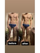 アヌヘア(Anuhea)/インディバ痩身120分