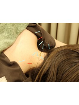 首・肩のつらさを改善したい