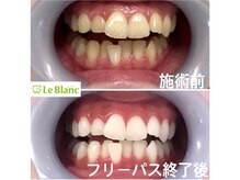 ルブラン 奈良店(Le Blanc)/第一印象大事です！