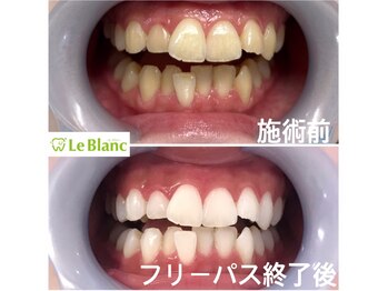 ルブラン 奈良店(Le Blanc)/第一印象大事です!