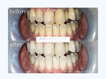 フロムトゥ バイ リアン(from to by Lien)の雰囲気（札幌/中央区/西18/円山/セルフホワイトニング/ホワイトニング）