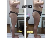 紬(TSUMUGI)の雰囲気（腰痛改善は身幅減へ導きます。美姿勢に大事なのは前側の縮み改善）