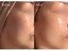 シューラディアント(ShuRadiant)/肌を底上げ