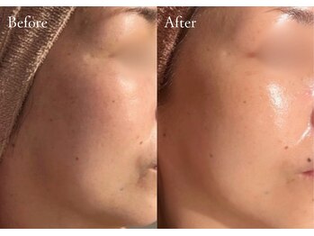 シューラディアント(ShuRadiant)/肌を底上げ