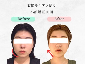 ウェリナ平和堂長久手院/小顔矯正/骨盤矯正/痩身/整体