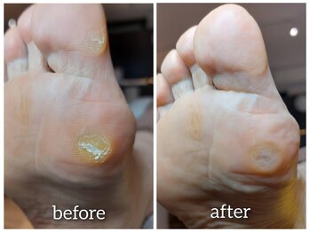 爪切り屋 足楽/原因はわかってます