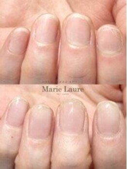 マリーロール 梅田店(Marie Laure)/自爪育成/深爪矯正/ネイルケア