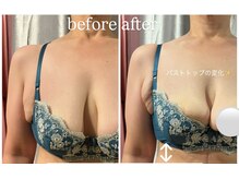 ビウラ(BIURA)/【40代】垂れ改善