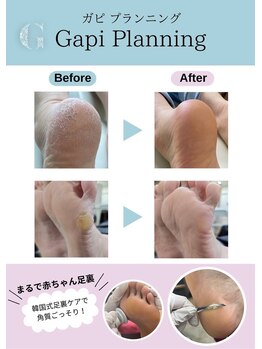 友スック ガピ かわぐち店(友SSOOK Gapi)/足裏ケア、角質ケア足裏ツルピカ