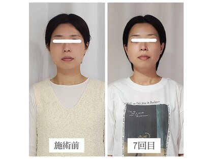 エクラ(eclat)の写真