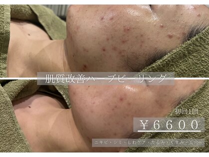 エステティック バイ マルキーズ(ESTHETIC by marquise)の写真