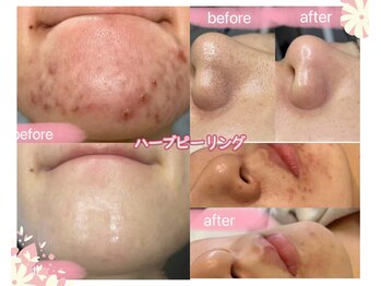 ミツレイ 九条店(MITUREI)