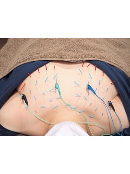 鍼灸施術を受けたい