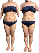 マロン(marron)/marron 痩身　　50代