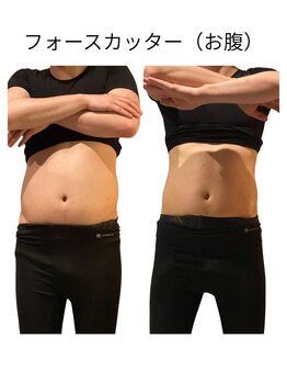 ビーアイリー(Be irie)/痩身エステ フォースカッター