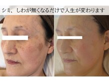 ラグランシエル(Le grand ciel)/肩甲骨はがし