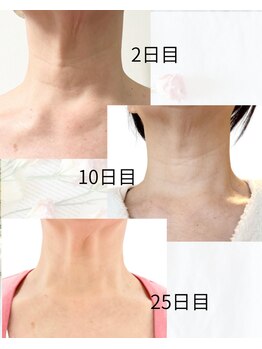 エステドブルー(Este de Bleu)/ビフォーアフター