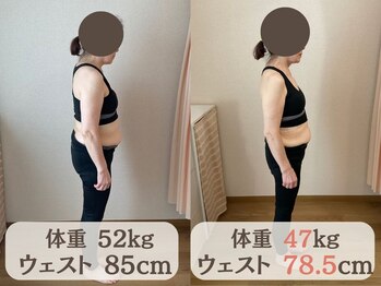 やくわ新坂町はり灸マッサージ治療院/体重-5kgですっきり！