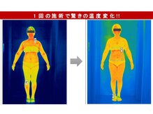 深部から温まり大量発汗!!冷え、むくみに効果/岡崎