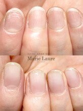マリーロール 梅田店(Marie Laure)/自爪育成/深爪矯正/ネイルケア