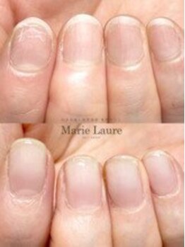 マリーロール 梅田店(Marie Laure)/自爪育成/深爪矯正/ネイルケア