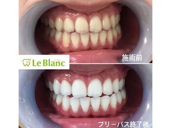 ルブラン 奈良店(Le Blanc)/白い歯で健康に!