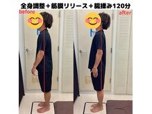 ソラ 新宿店(SORA)の雰囲気（ビフォーアフター写真で撮影施術後の変化を見て効果を実感。）