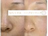 【夏の毛穴/くすみ】今だけ鼻の毛穴ケア付の剥離無ハーブピーリング¥23000→