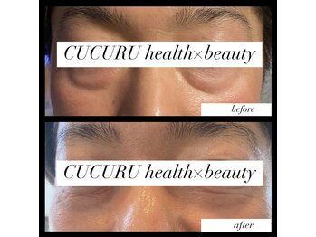 ククルヘルスビューティー(CUCURU health×beauty)/レモンボトルで目の下の脂肪ケア