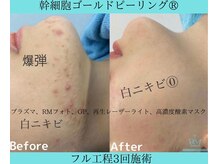 リメイククリニカルビューティー(Remake clinical beauty)/