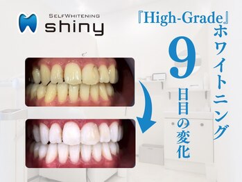 ホワイトニングサロン シャイニー 浜松細島店(shiny)/【超絶・美・白】ホワイトニング