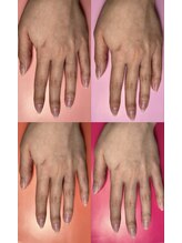 ユルックネイル(yluck nail)/カウンセリング/似合わせ