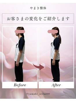 押上やまき整体の写真/反り腰や巻き肩・猫背などお悩みに合わせて、理想の姿勢になれるよう、お身体を徹底サポート！！