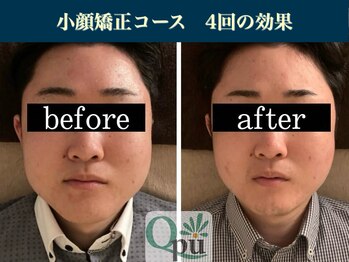 キュープ 表参道店(Qpu)/続けた方しか感じられない変化♪