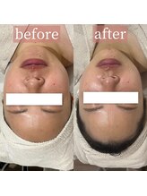 アディクトウラ(Addict'ula)/ホワイトブレイズ